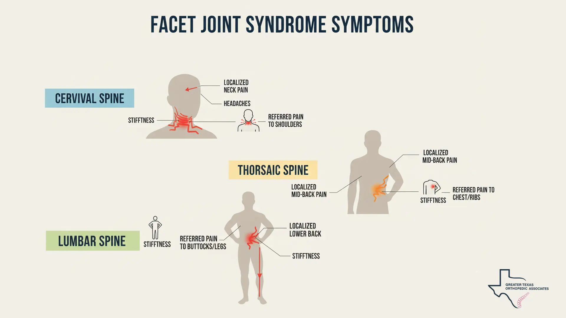 Facet Syndrome Symptoms and Their Locations