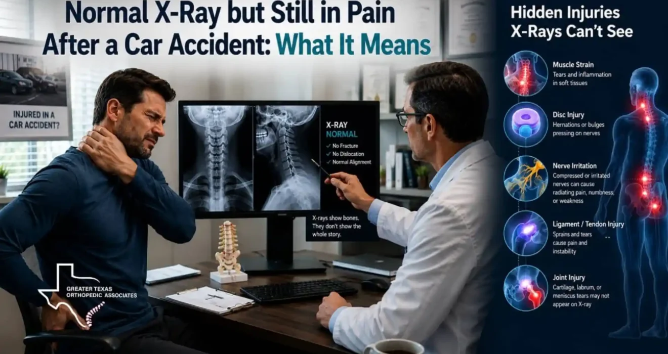 Normal X-Ray but Still in Pain After a Car Accident? What It Could Mean
