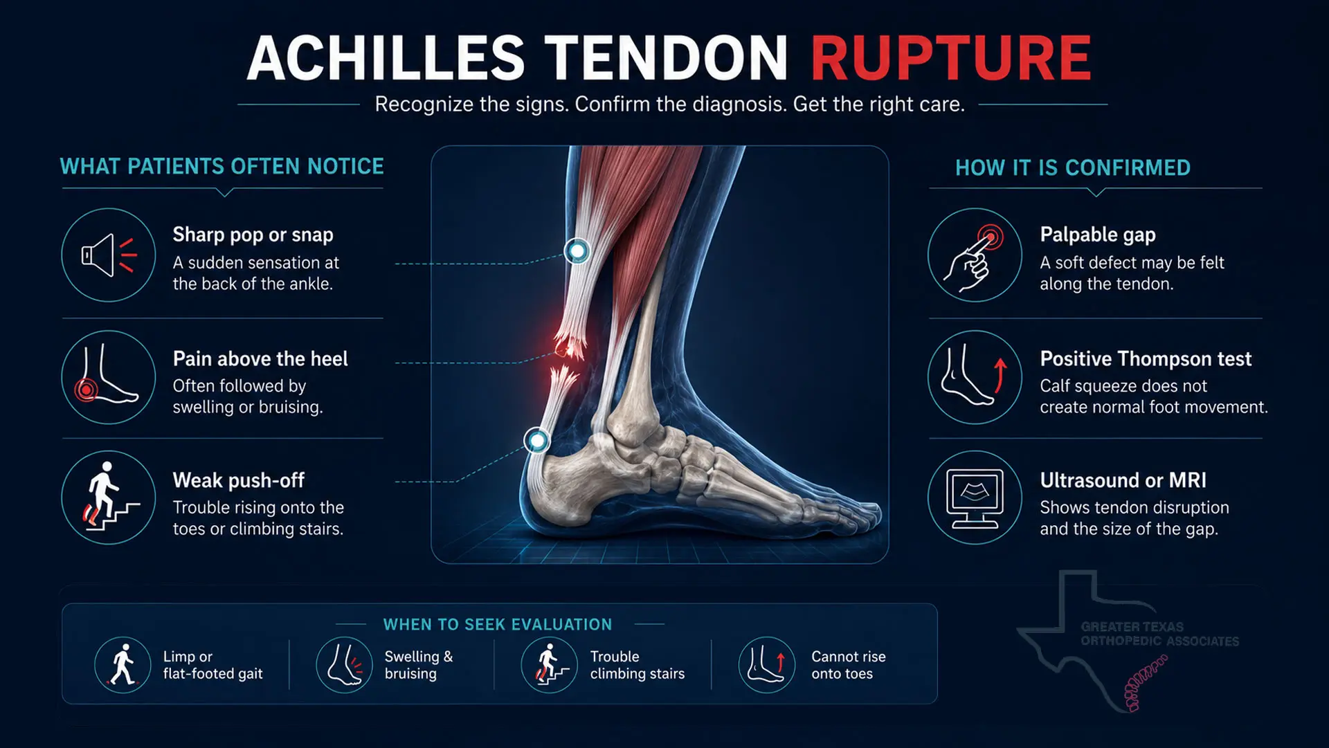 Infographic showing Achilles tendon rupture symptoms, Thompson test, imaging, and signs that need evaluation